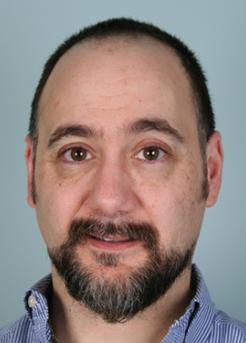 Before Hair Transplant&nbsp;Front